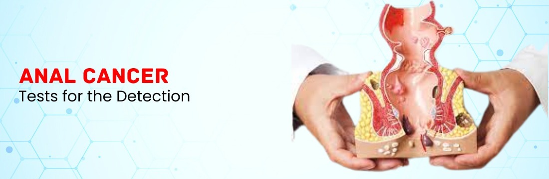 Tests Are Used for the Detection of Anal Cancer